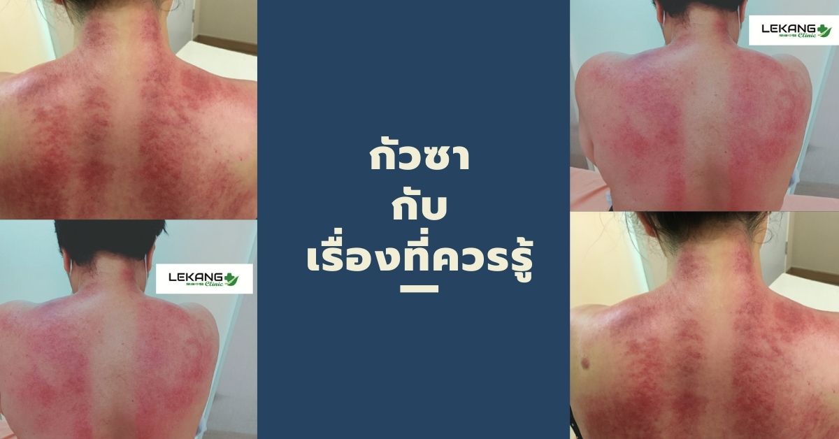 Lekang Clinic Traditional Chinese Medicine Lekang Clinic แพทย์แผนจีน